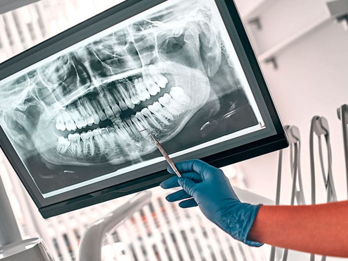 Quanto ganha um dentista e saiba mais sobre a profiss o CashMe